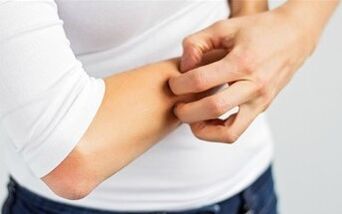 Il prurito può essere chiamato il primo segno della malattia