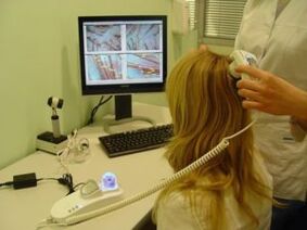 Diagnosi della psoriasi sul cuoio capelluto